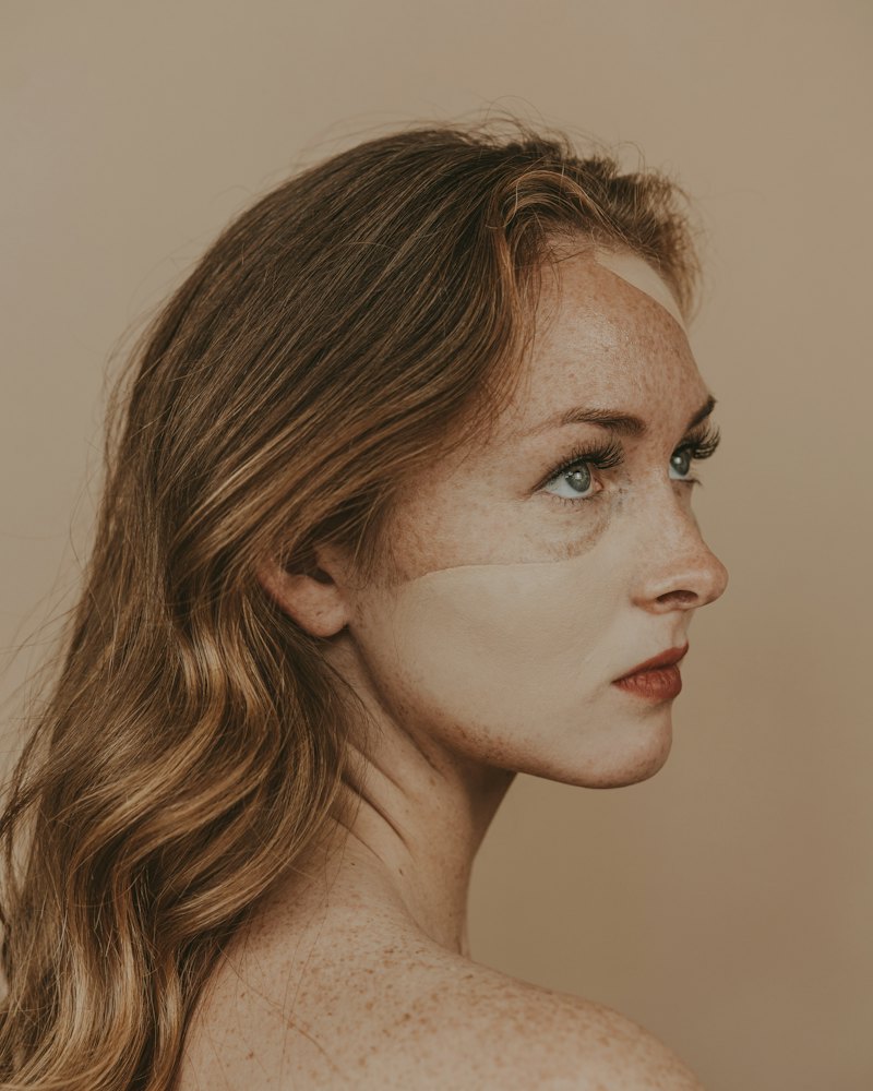 Armonización facial